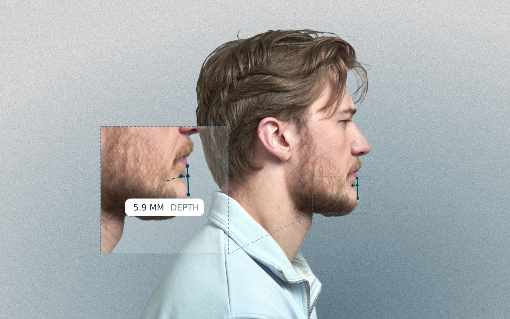 Mentolabial depth measured on a male side-profile portrait
