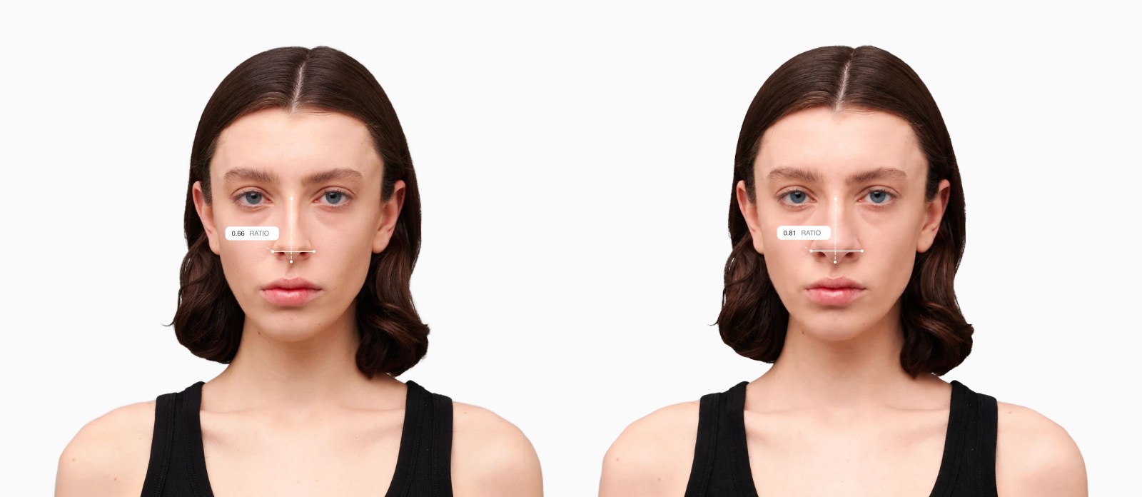 Two copies of the same female front-facing face with the nasal aspect ratio drawn on each, the right one with a wider nose Two copies of the same female front-facing face with the nasal aspect ratio drawn on each, the right one with a wider nose