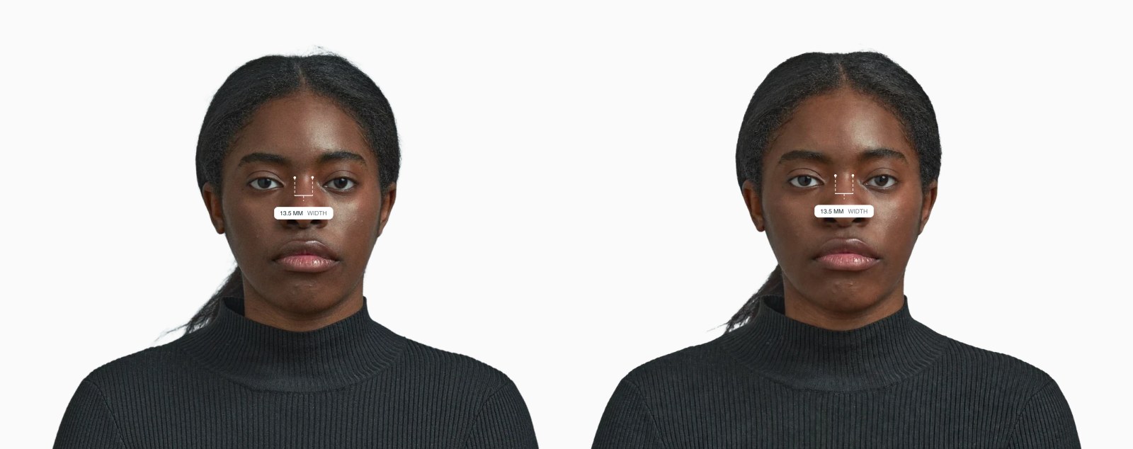 Two copies of the same female front-facing face with the nasal bridge width drawn on each, the right one with a reshaped nose Two copies of the same female front-facing face with the nasal bridge width drawn on each, the right one with a reshaped nose