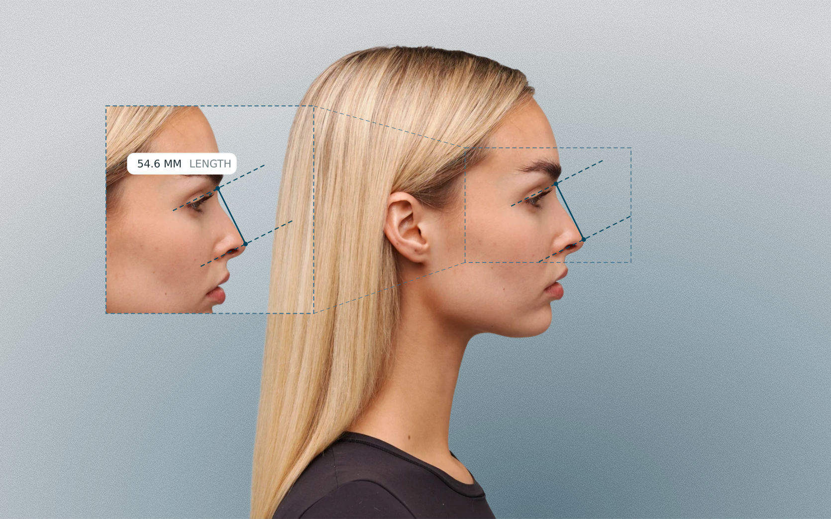 Nasal length measured on a female side-profile portrait