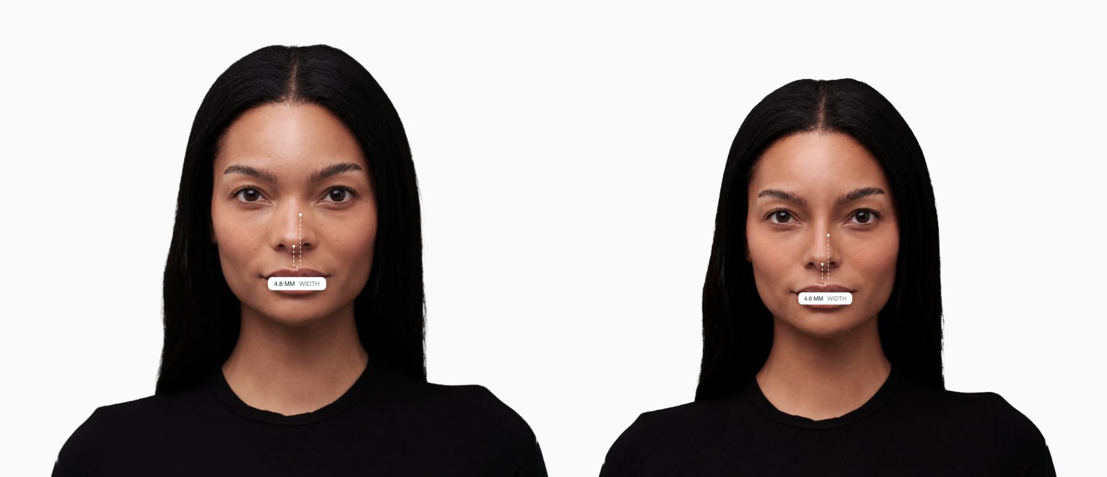 Two copies of the same female front-facing face with the nasal root width drawn on each, the right one with a narrower nasal root Two copies of the same female front-facing face with the nasal root width drawn on each, the right one with a narrower nasal root