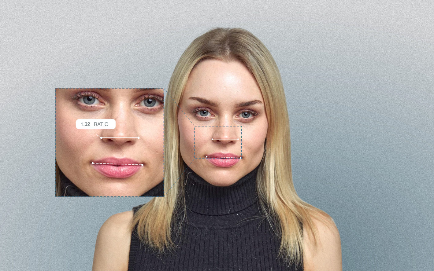 Naso-oral ratio measured on a female front-facing portrait Naso-oral ratio measured on a female front-facing portrait