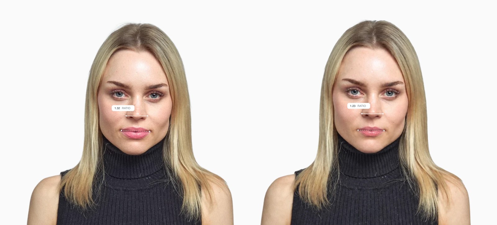 Two copies of the same female front-facing face with the naso-oral ratio drawn on each, the right one with a wider nose relative to the mouth Two copies of the same female front-facing face with the naso-oral ratio drawn on each, the right one with a wider nose relative to the mouth