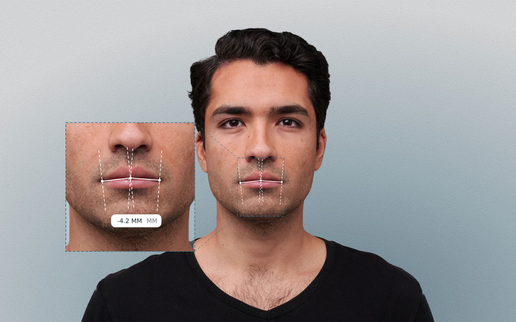 Oral commissure tilt measured on a male front-facing portrait Oral commissure tilt measured on a male front-facing portrait