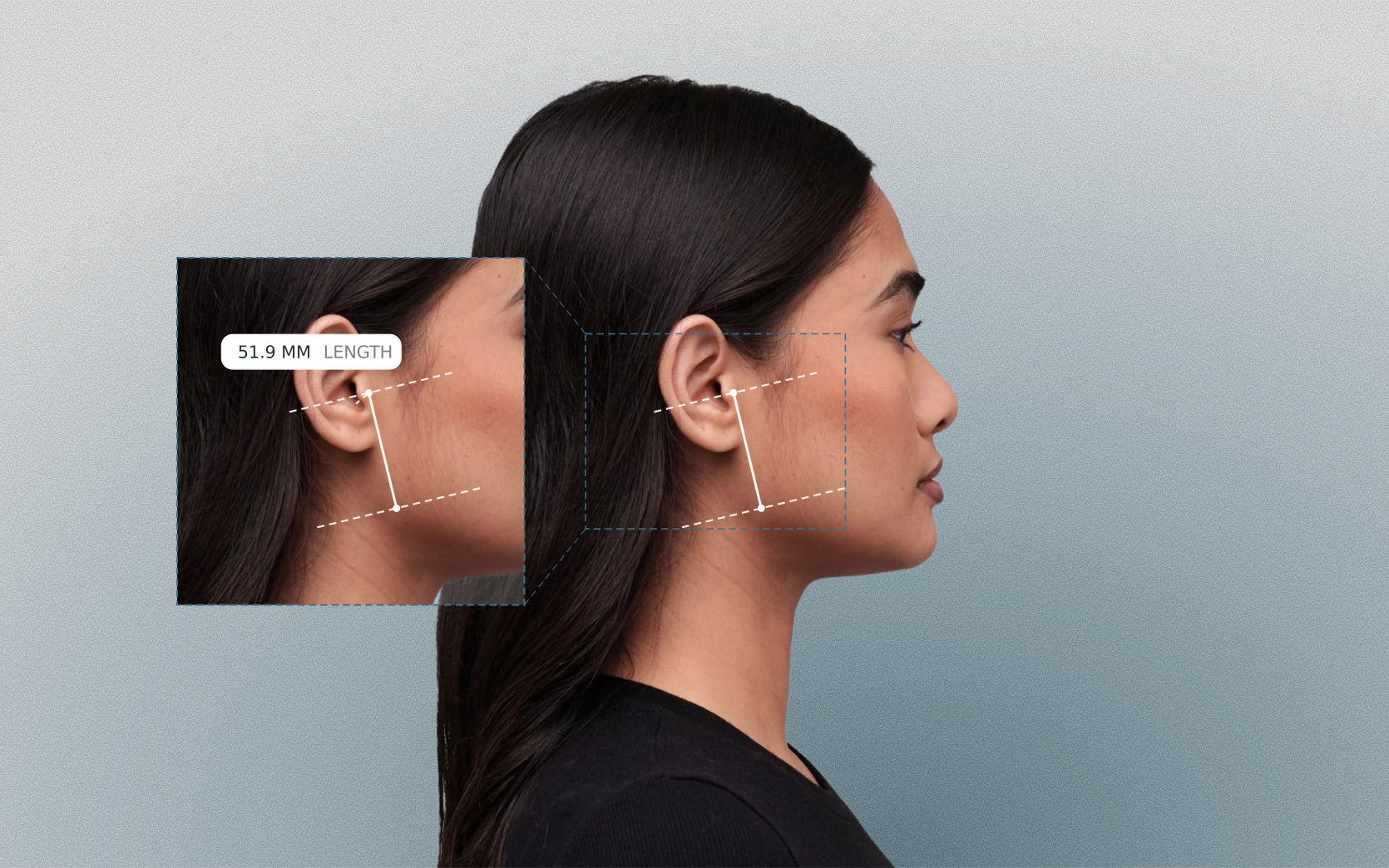 Ramus length measured on a female side-profile portrait Ramus length measured on a female side-profile portrait