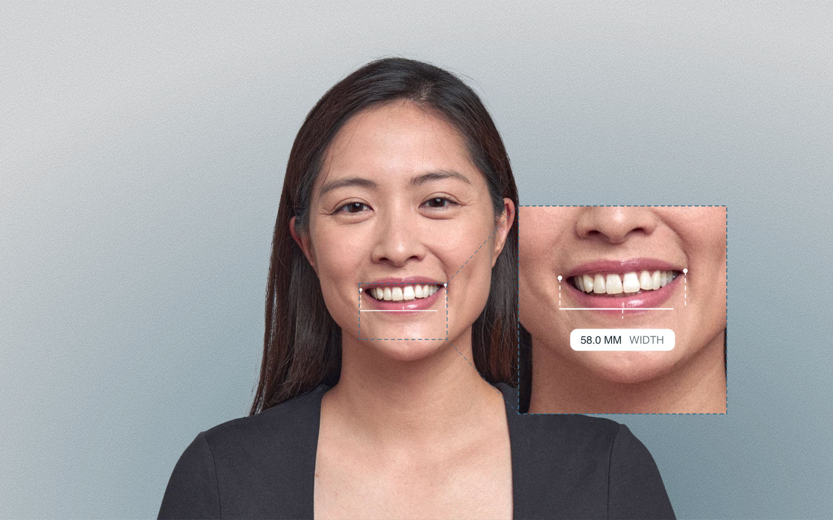 Smile width measured as the intercommissural distance between the mouth corners on a female frontal portrait Smile width measured as the intercommissural distance between the mouth corners on a female frontal portrait