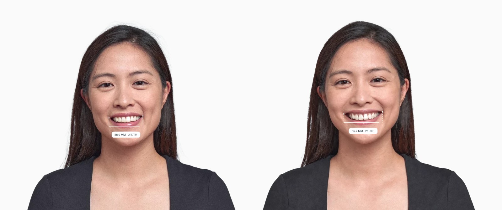 The same female face with a narrower smile on the left and a wider smile on the right, mouth width drawn on each The same female face with a narrower smile on the left and a wider smile on the right, mouth width drawn on each
