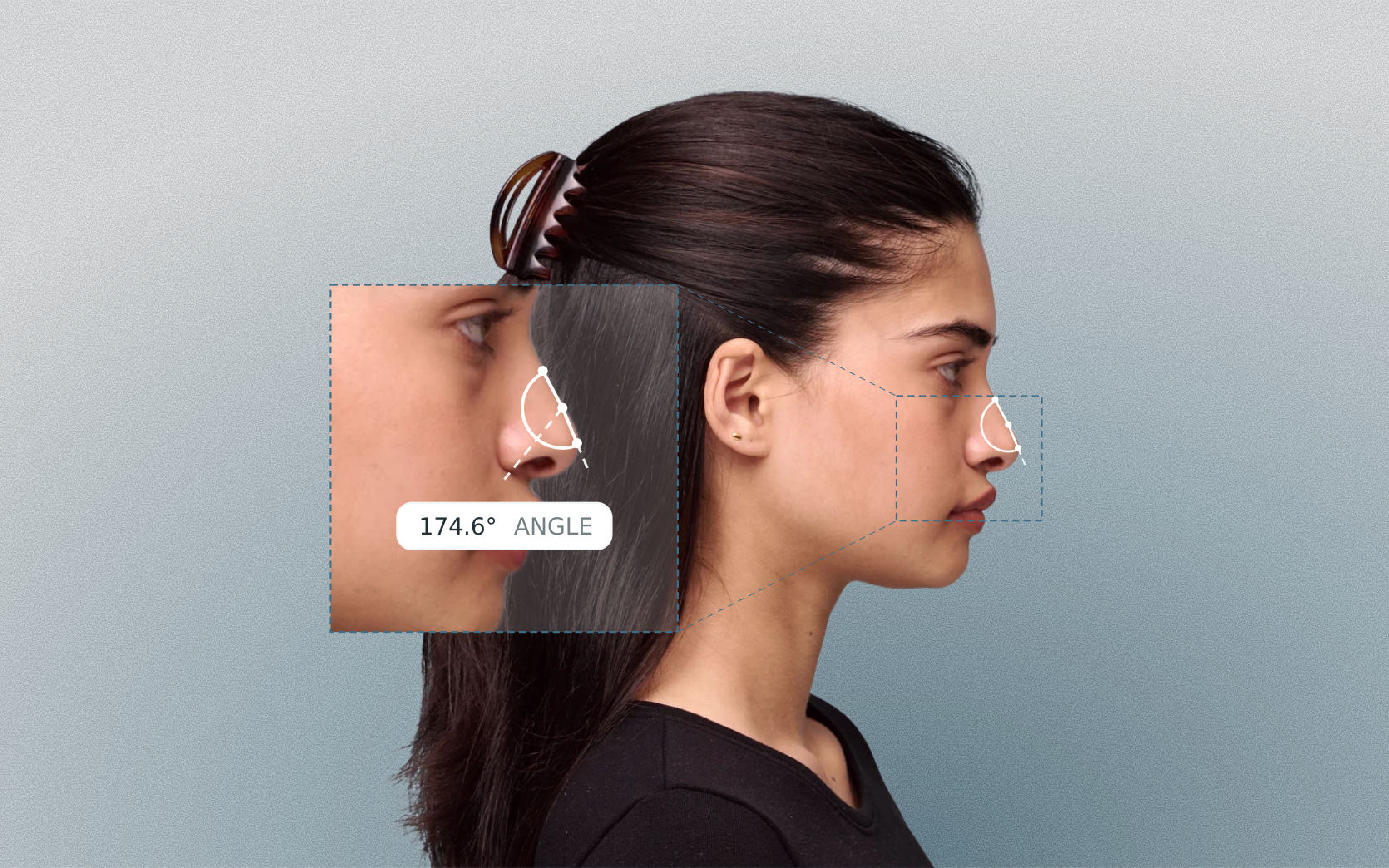 Supratip break angle measured on a female side-profile portrait Supratip break angle measured on a female side-profile portrait