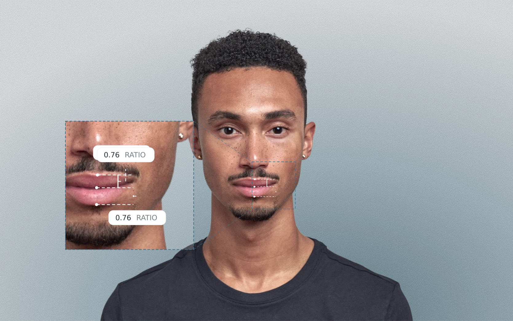 Upper-to-lower lip ratio measured on a male front-facing portrait Upper-to-lower lip ratio measured on a male front-facing portrait