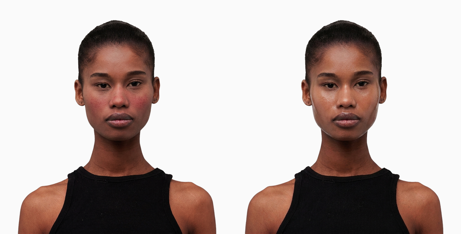 Dull, dehydrated skin before and after an oxygen facial