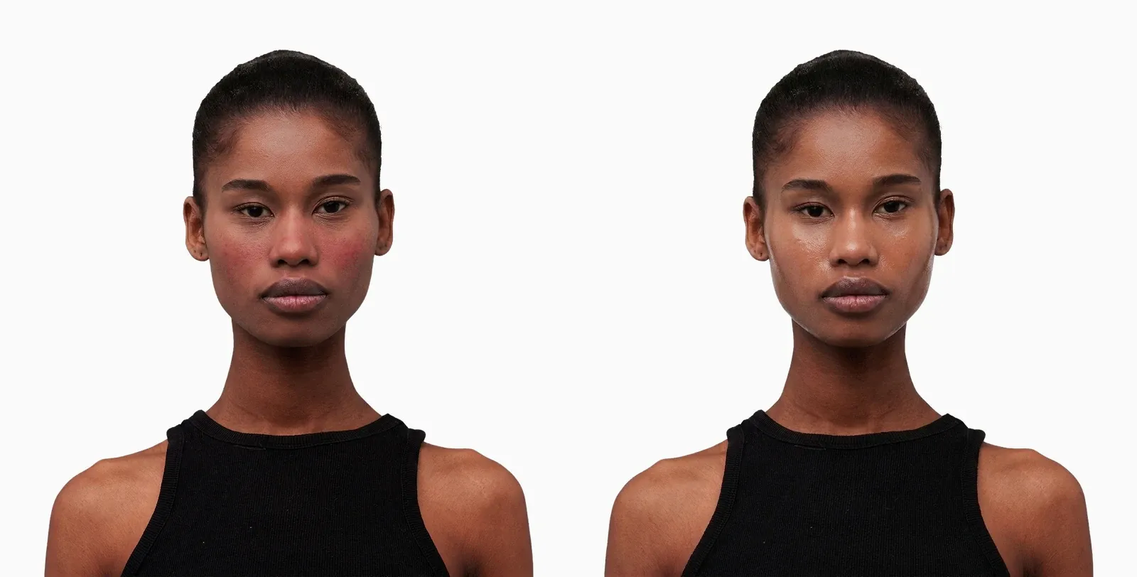 Dull, dehydrated skin before and after an oxygen facial