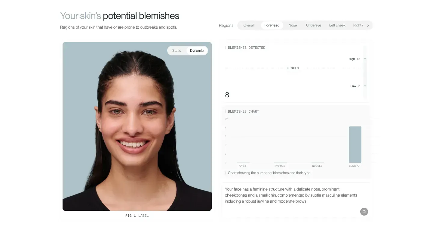 QOVES blemish analysis card with a skin score and detected blemishes mapped across facial regions