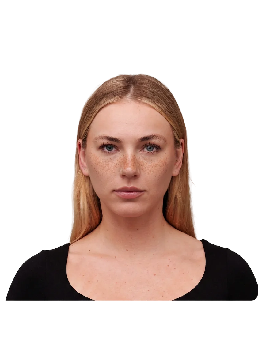 The same portrait with digitally added freckles