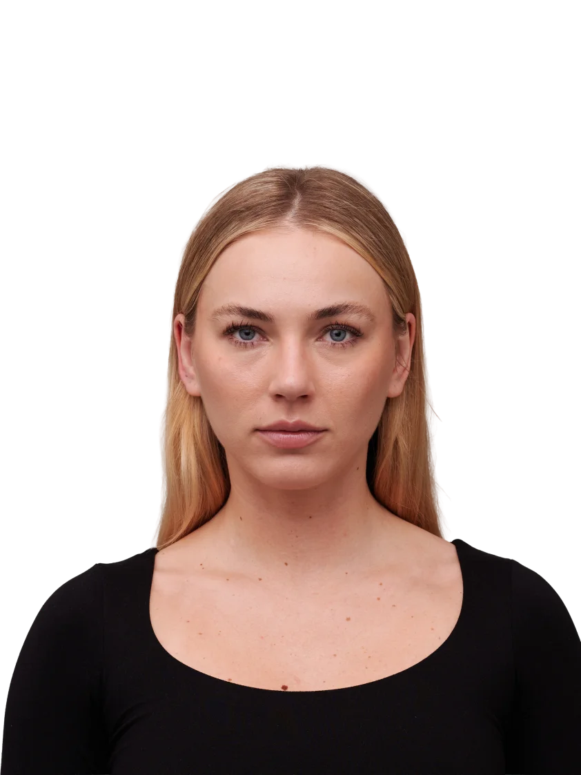 Front-facing portrait of a woman without freckles